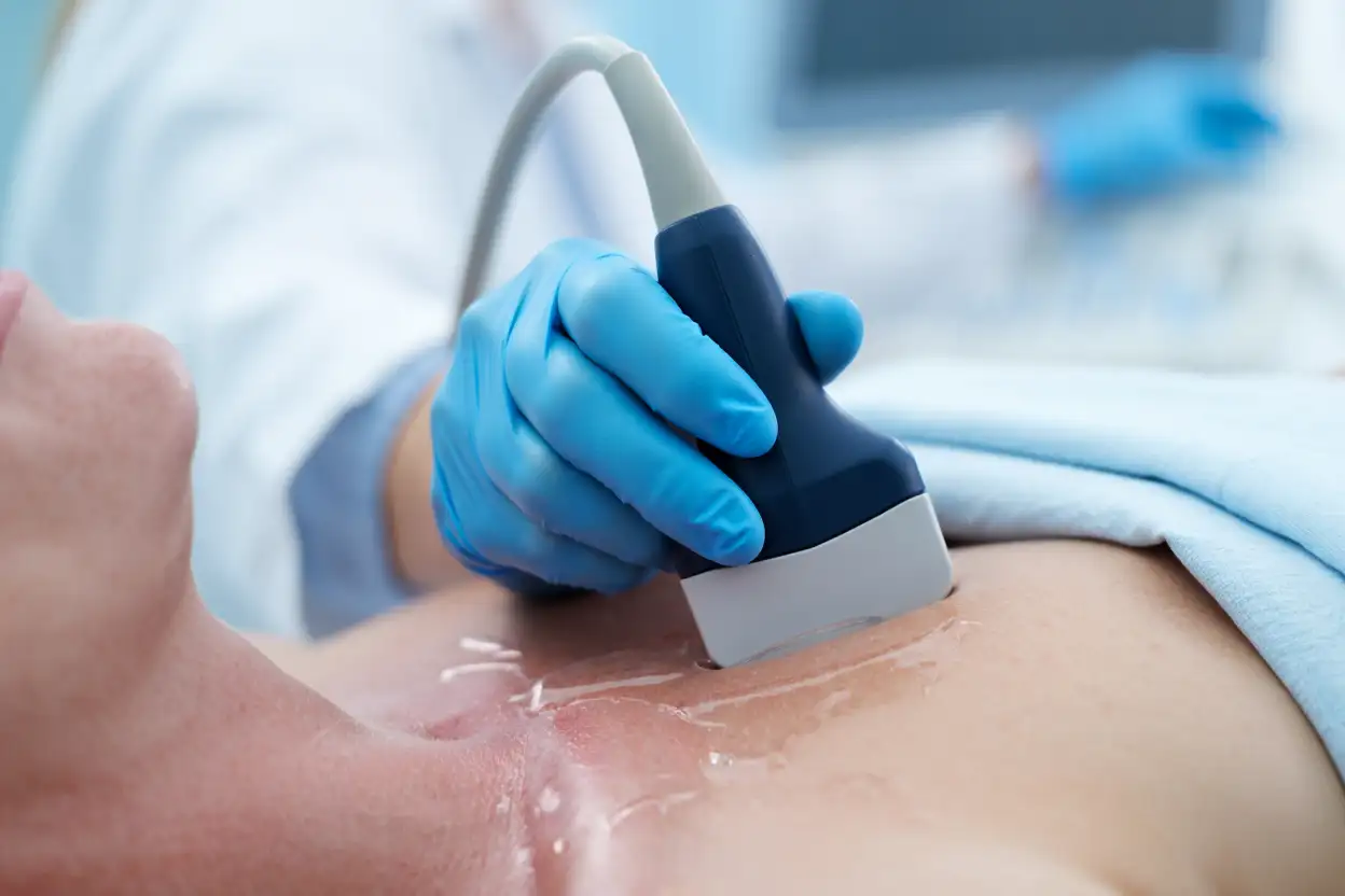 УЗИ сердца (эхокардиография) в Медицинском центре «Бригид»: точная диагностика