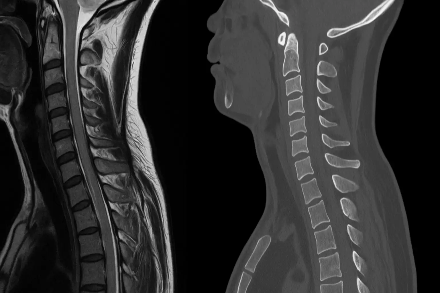 КТ и МРТ позвоночника: отличия, показания и преимущества