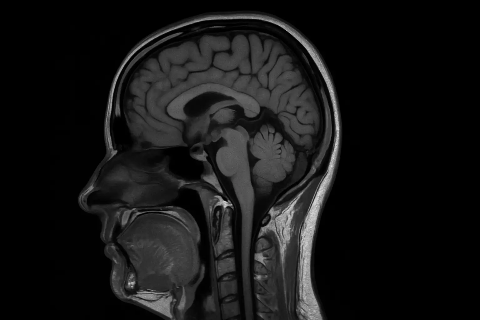 МРТ головного мозга и сосудов: отличия, показания и противопоказания
